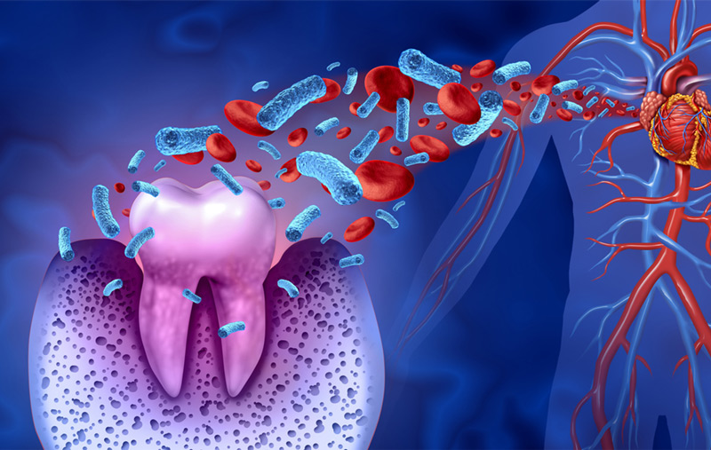 New Hope for Gum Disease Sufferers: Metformin's Astonishing Impact on Oral Health